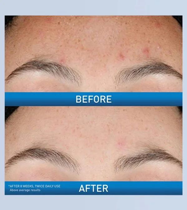 CeraVe Retinol Serum 30ml