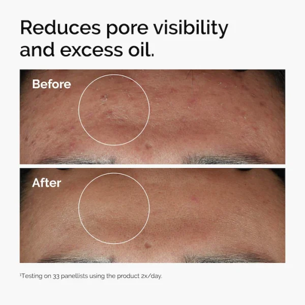 Niacinamide 10% + Zinc 1%  Serum for Oily Skin 30ml