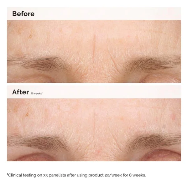 Retinal 0.2% Emulsion High-Strength Retinoid Nighttime Treatment